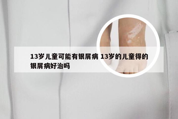 13岁儿童可能有银屑病 13岁的儿童得的银屑病好治吗