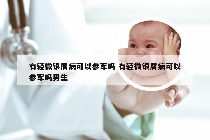 有轻微银屑病可以参军吗 有轻微银屑病可以参军吗男生