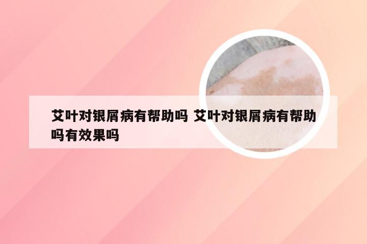 艾叶对银屑病有帮助吗 艾叶对银屑病有帮助吗有效果吗