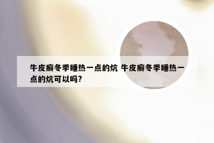 牛皮癣冬季睡热一点的炕 牛皮癣冬季睡热一点的炕可以吗?