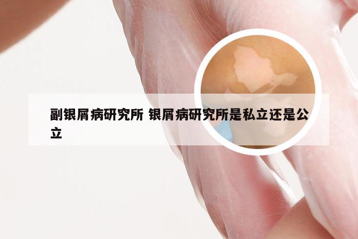 副银屑病研究所 银屑病研究所是私立还是公立