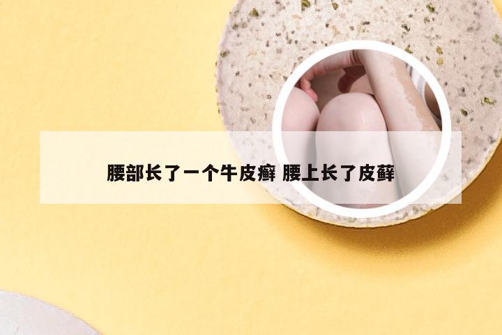 腰部长了一个牛皮癣 腰上长了皮藓