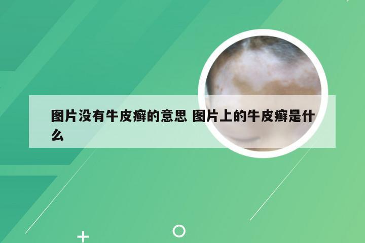 图片没有牛皮癣的意思 图片上的牛皮癣是什么