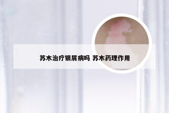 苏木治疗银屑病吗 苏木药理作用