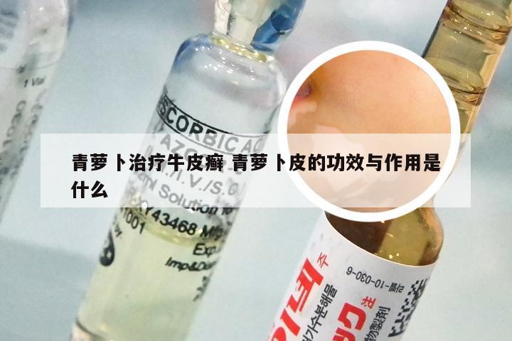 青萝卜治疗牛皮癣 青萝卜皮的功效与作用是什么