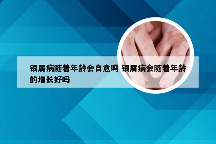 银屑病随着年龄会自愈吗 银屑病会随着年龄的增长好吗
