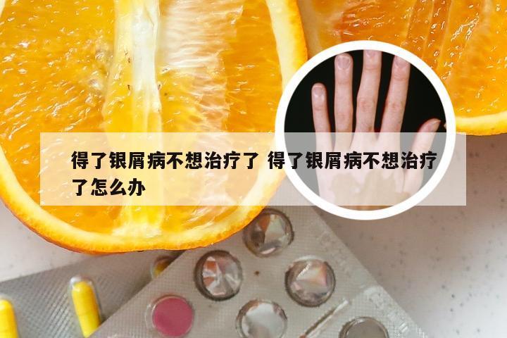 得了银屑病不想治疗了 得了银屑病不想治疗了怎么办
