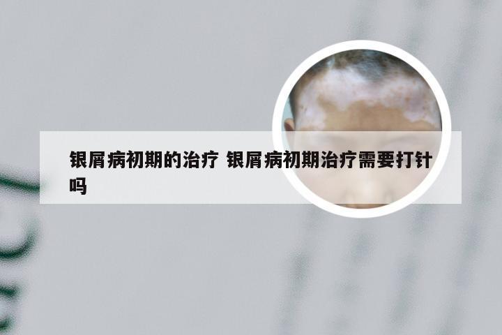 银屑病初期的治疗 银屑病初期治疗需要打针吗