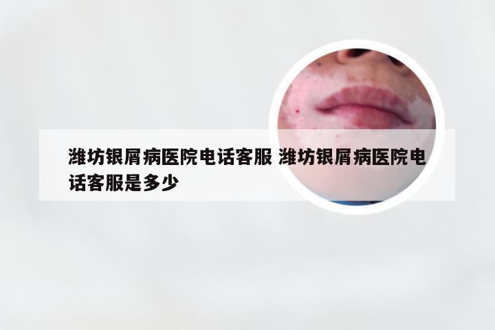 潍坊银屑病医院电话客服 潍坊银屑病医院电话客服是多少