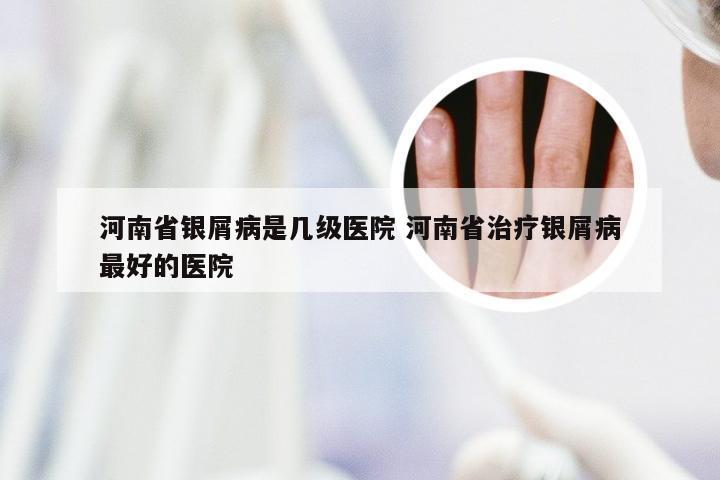 河南省银屑病是几级医院 河南省治疗银屑病最好的医院