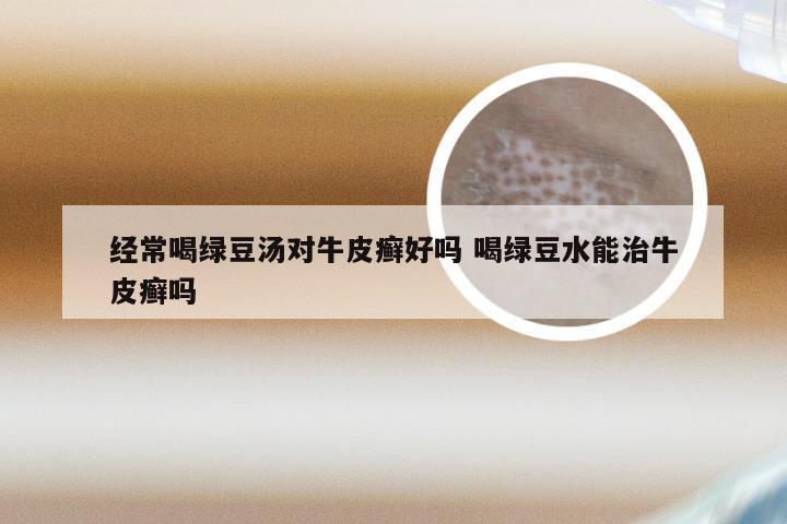 经常喝绿豆汤对牛皮癣好吗 喝绿豆水能治牛皮癣吗