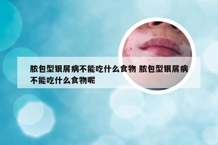 脓包型银屑病不能吃什么食物 脓包型银屑病不能吃什么食物呢