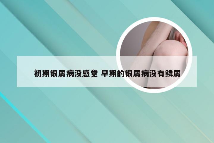 初期银屑病没感觉 早期的银屑病没有鳞屑