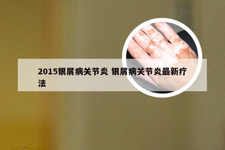 2015银屑病关节炎 银屑病关节炎最新疗法