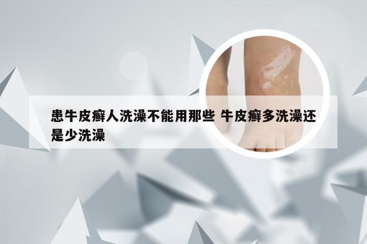 患牛皮癣人洗澡不能用那些 牛皮癣多洗澡还是少洗澡