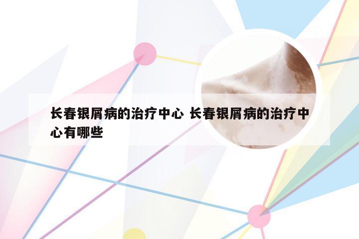 长春银屑病的治疗中心 长春银屑病的治疗中心有哪些
