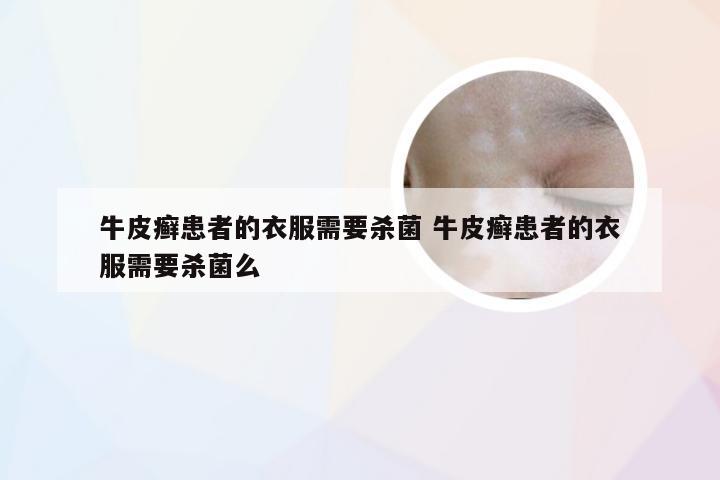 牛皮癣患者的衣服需要杀菌 牛皮癣患者的衣服需要杀菌么