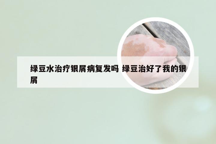 绿豆水治疗银屑病复发吗 绿豆治好了我的银屑