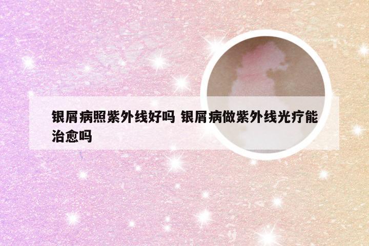 银屑病照紫外线好吗 银屑病做紫外线光疗能治愈吗