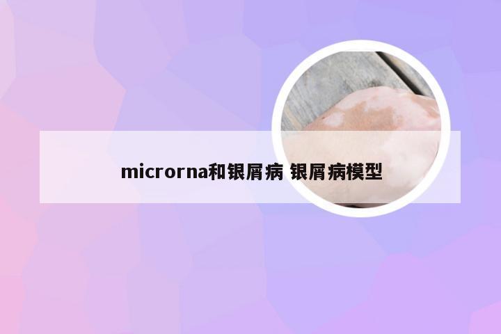 microrna和银屑病 银屑病模型