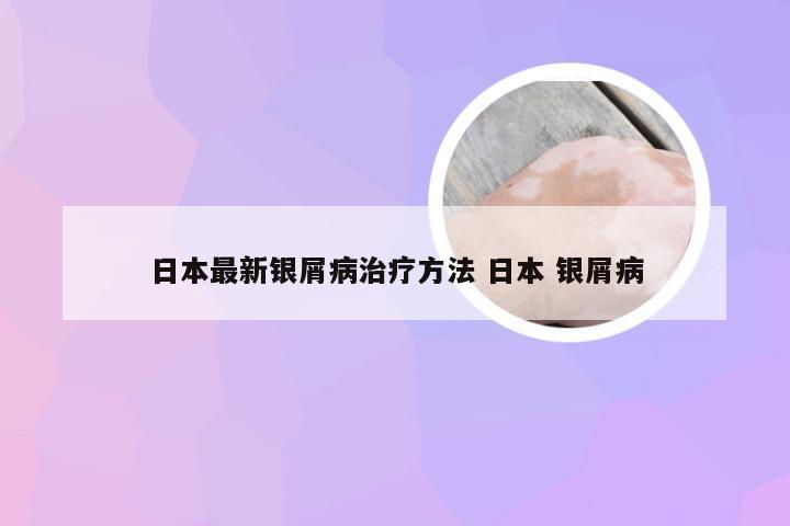 日本最新银屑病治疗方法 日本 银屑病