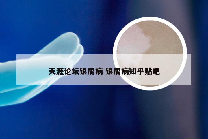 天涯论坛银屑病 银屑病知乎贴吧