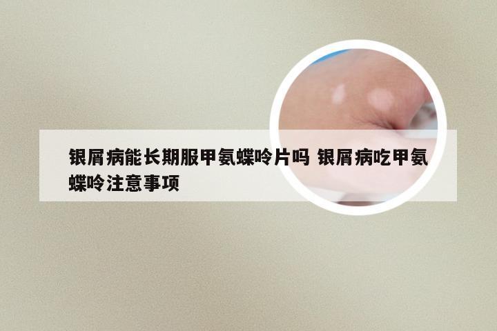 银屑病能长期服甲氨蝶呤片吗 银屑病吃甲氨蝶呤注意事项