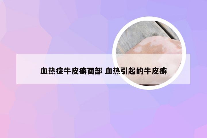 血热症牛皮癣面部 血热引起的牛皮癣