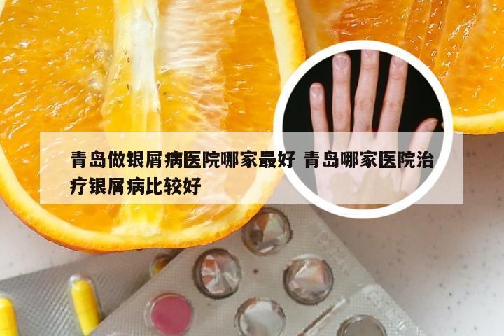 青岛做银屑病医院哪家最好 青岛哪家医院治疗银屑病比较好