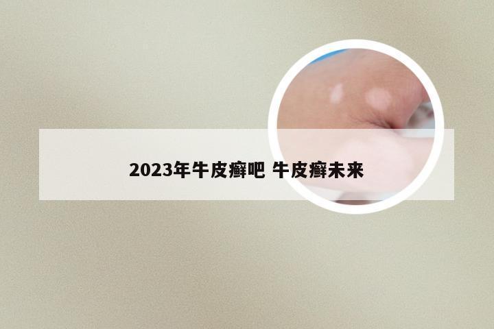 2023年牛皮癣吧 牛皮癣未来