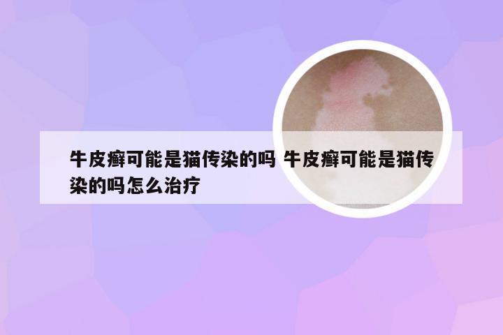 牛皮癣可能是猫传染的吗 牛皮癣可能是猫传染的吗怎么治疗