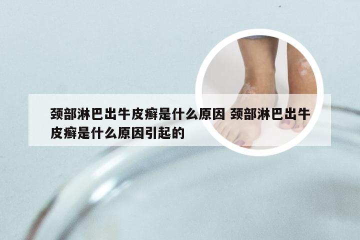 颈部淋巴出牛皮癣是什么原因 颈部淋巴出牛皮癣是什么原因引起的