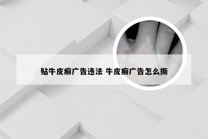 贴牛皮癣广告违法 牛皮癣广告怎么撕