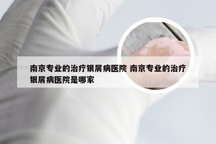 南京专业的治疗银屑病医院 南京专业的治疗银屑病医院是哪家