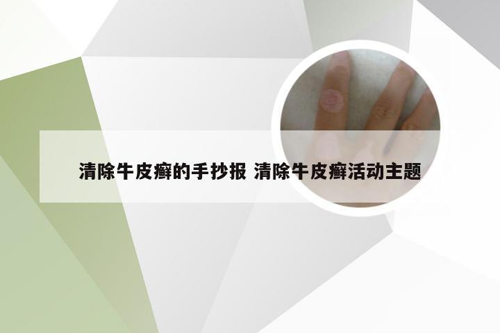清除牛皮癣的手抄报 清除牛皮癣活动主题
