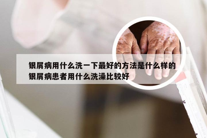 银屑病用什么洗一下最好的方法是什么样的 银屑病患者用什么洗澡比较好
