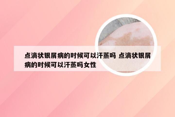 点滴状银屑病的时候可以汗蒸吗 点滴状银屑病的时候可以汗蒸吗女性