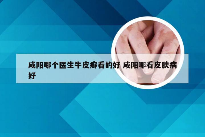咸阳哪个医生牛皮癣看的好 咸阳哪看皮肤病好