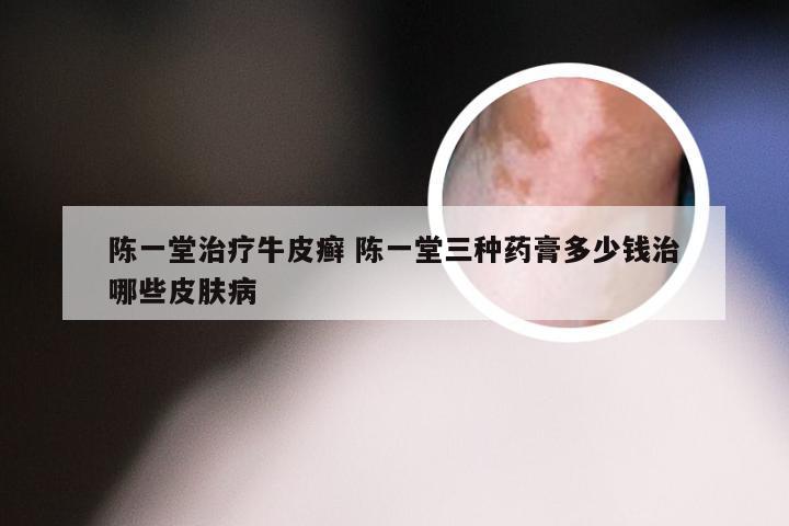 陈一堂治疗牛皮癣 陈一堂三种药膏多少钱治哪些皮肤病