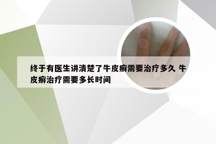 终于有医生讲清楚了牛皮癣需要治疗多久 牛皮癣治疗需要多长时间