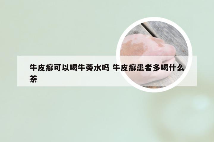 牛皮癣可以喝牛蒡水吗 牛皮癣患者多喝什么茶