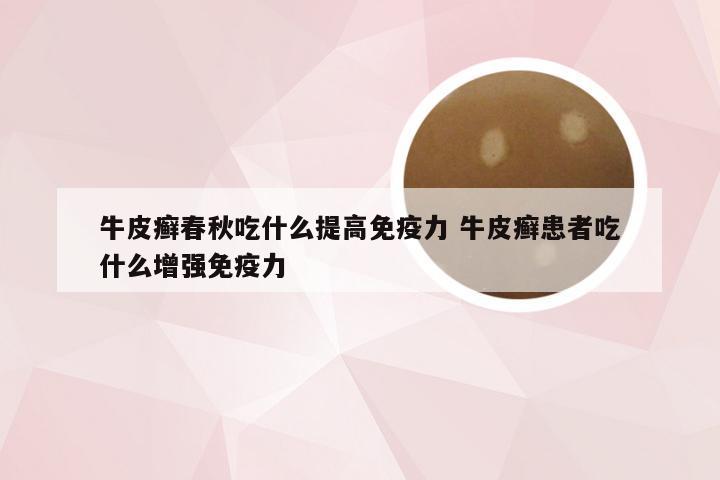 牛皮癣春秋吃什么提高免疫力 牛皮癣患者吃什么增强免疫力