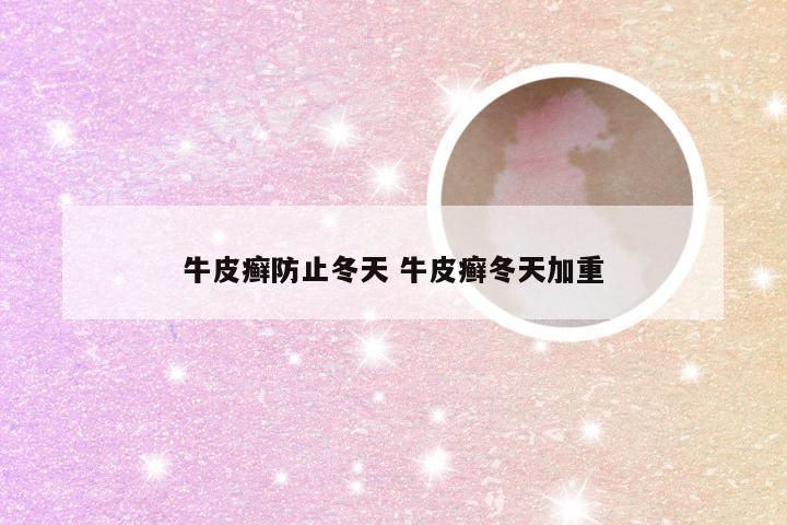 牛皮癣防止冬天 牛皮癣冬天加重