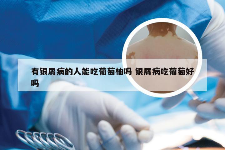 有银屑病的人能吃葡萄柚吗 银屑病吃葡萄好吗