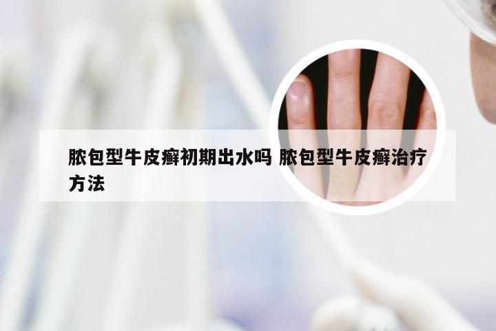 脓包型牛皮癣初期出水吗 脓包型牛皮癣治疗方法