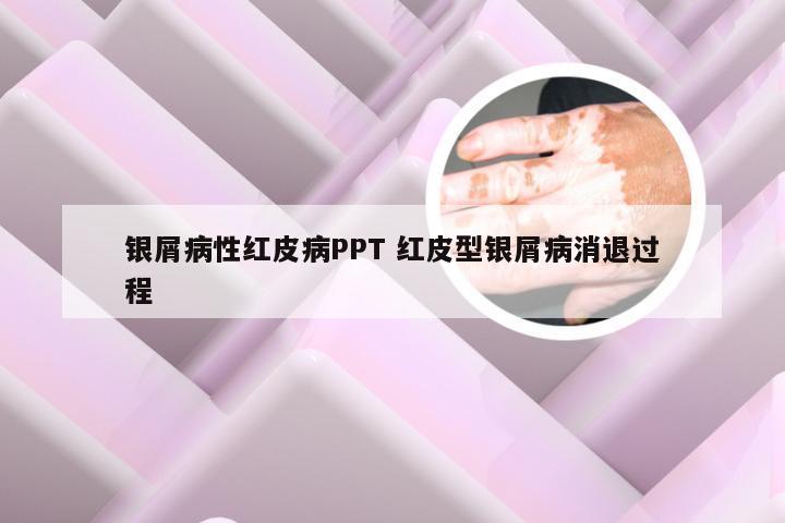 银屑病性红皮病PPT 红皮型银屑病消退过程