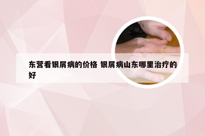 东营看银屑病的价格 银屑病山东哪里治疗的好