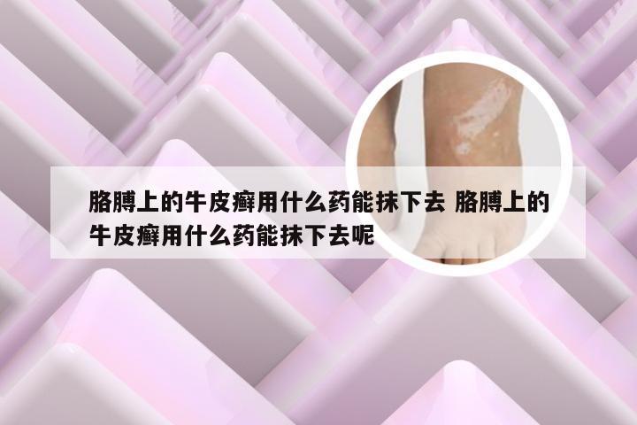 胳膊上的牛皮癣用什么药能抹下去 胳膊上的牛皮癣用什么药能抹下去呢