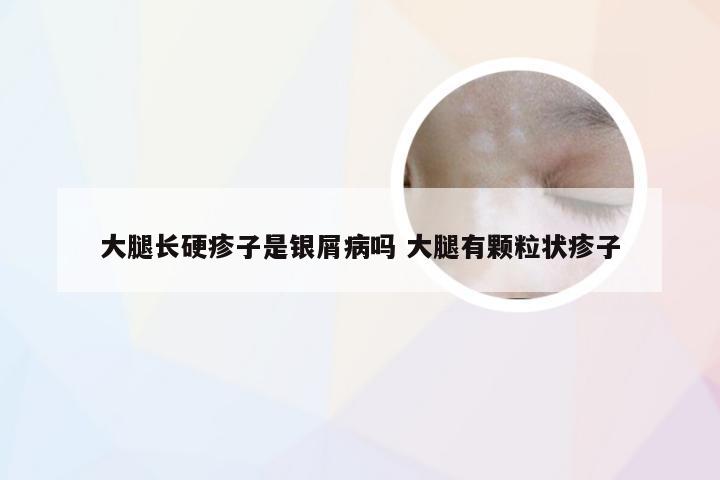 大腿长硬疹子是银屑病吗 大腿有颗粒状疹子