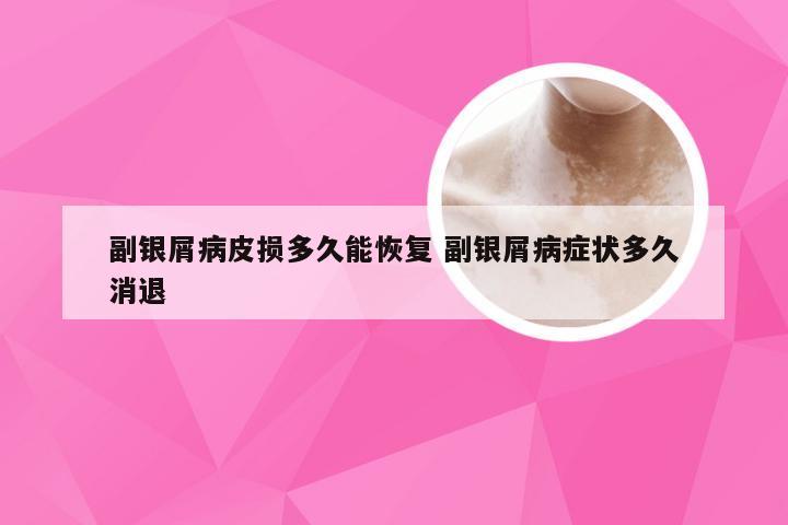 副银屑病皮损多久能恢复 副银屑病症状多久消退